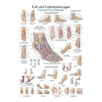 Lehrtafel "Fuß und Fußerkrankungen"